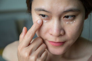Asian woman applying anti aging cream on her under eyes. The anti aging cream is using to reducing,...