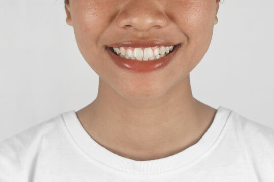 Close up of a woman toothy smile on white background.