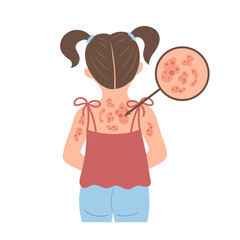 Allergic itching, skin inflammation, redness and irritation. A child with allergies. Healthcare and medicine. Vector