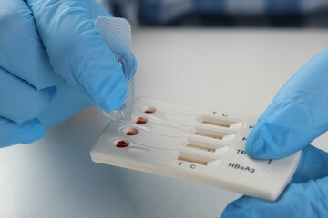 Doctor dropping buffer solution onto disposable multi-infection express test cassette at white table, closeup © New Africa