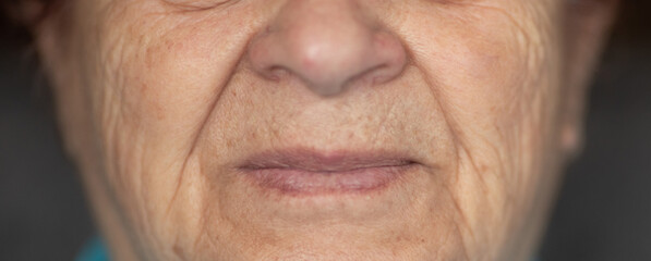 Wrinkled skin, nose and mouth of a mature caucasian woman, moles, real person. Close-up, selective...