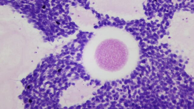 Ovary. Microanatomy. Fertility. 400x optical magnification. HQ video. Place of production and release of oocytes - female gametes. Infertility. Surrogacy. Human cloning