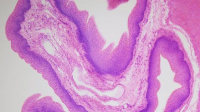 Stratified squamous epithelium. Microanatomy. 100x times magnification. Forms the outermost layer of the skin and the inner lining of the mouth, esophagus and vagina.