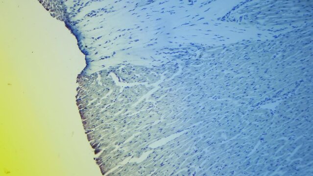 Histologic study of human heart muscle under a microscope. 100x magnification. Heart failure and natural deterioration. Color filter