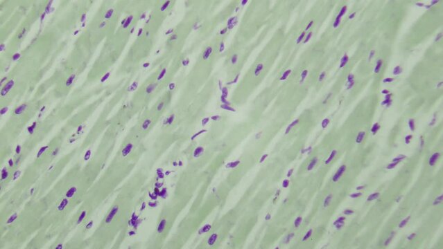 Human heart muscle under a microscope. 400x times magnification. Pathologist examines heart tissue after a heart attack
