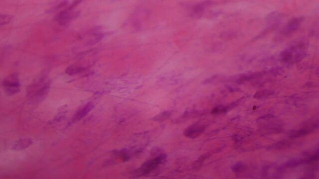 Loose connective tissue under the microscope. 400x magnification. Fibroblasts and collagen fibers. Anti-aging medicine