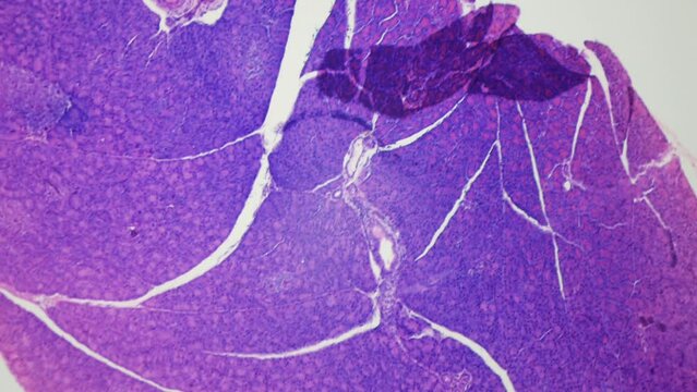 Pancreas. Microanatomy. Pancreatic biopsy section. 100x magnification. Digestive system of animals and humans, external secretory (exocrine) and intrasecretory (endocrine) functions