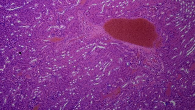 Kidney under the microscope, longitudinal section. Histologic and cytologic examination. Blood purification, regulation of chemical homeostasis of the body. 100x magnification