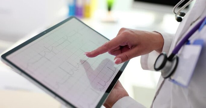 Digital tablet with electrocardiogram in hands of cardiologist in clinic