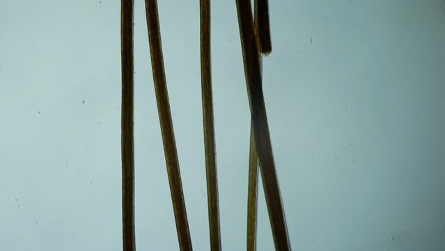 Brittle, emaciated hair. Trichology lab. Human hair under the microscope.  The effects of chemical hair care products. 100X times magnification