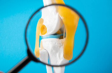 Medical mockup of a knee joint on a blue background under a magnifying glass. Knee joint problems...