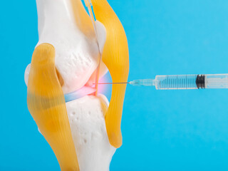 Drug blockade in a mock-up of the knee joint on a blue background. The concept of treating joints...