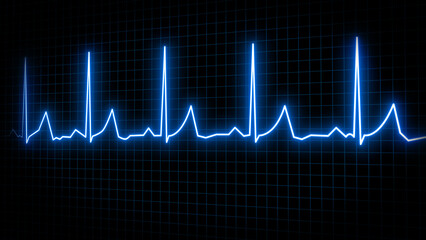 Heart rate electrocardiogram medical screen with grid background