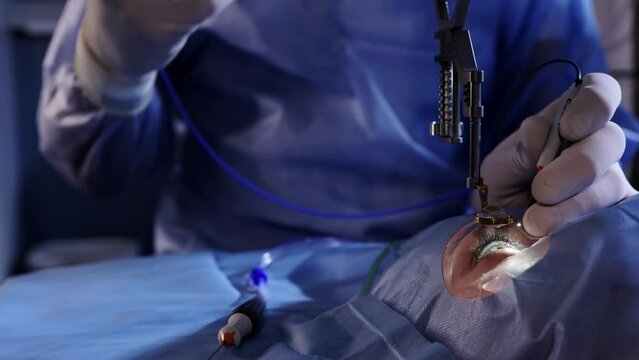 Ophthalmologist holds the tool devices in hands. Doctor performs operation on the eye looking at lens. Close up. A major operation to restore vision under an ophthalmological microscope. 