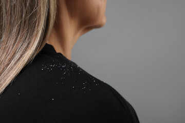 Woman with dandruff on her sweater against gray background, closeup. Space for text