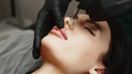 Injection procedure for lip augmentation, close-up. The cosmetologist slowly and carefully injects...