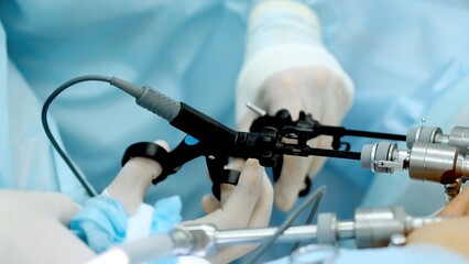 Hands of surgeons with the help of endoscopic equipment and instruments operate. performing...