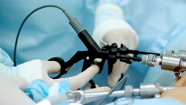 Hands of surgeons with the help of endoscopic equipment and instruments operate. performing laparoscopic surgery using endoscopic and laparoscopic instruments. laparoscopic instrument. 