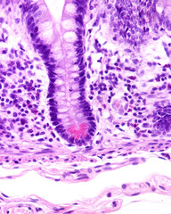 Small intestine. Paneth cells