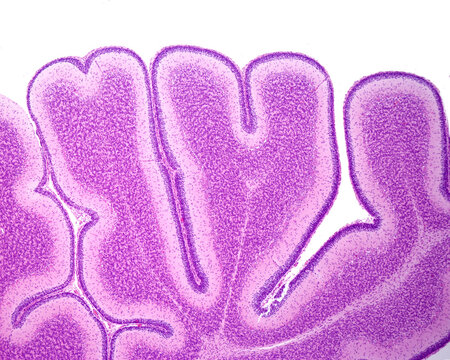 Immature cerebellum. External granular layer