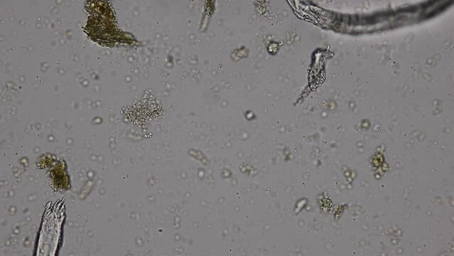 Finding Trichuris trichiura egg and Strongyloides egg in the feces under the microscope in Lab.