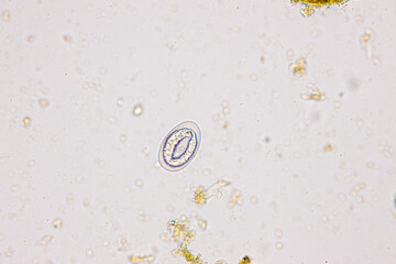 Finding Trichuris trichiura egg and Strongyloides egg in the feces under the microscope in Lab.