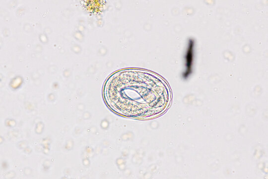 Finding Trichuris trichiura egg and Strongyloides egg in the feces under the microscope in Lab.