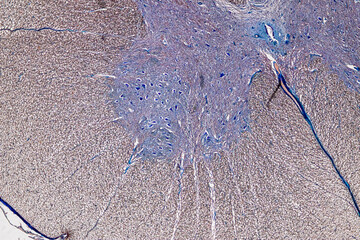 Histological Cerebellum human, Sympathetic ganglion human And Spinal cord human under the microscope for education.