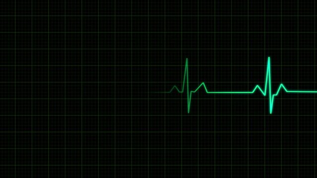 Heart rate monitor restart after failure with sound isolated with an alpha channel