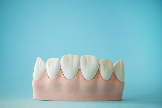 Jaw and teeth made of plaster. layout on a blue background.