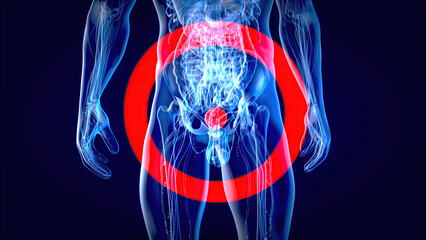 Abstract 3D illustration of the bladder cancer