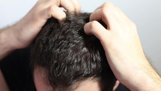 a man has an itchy head close-up