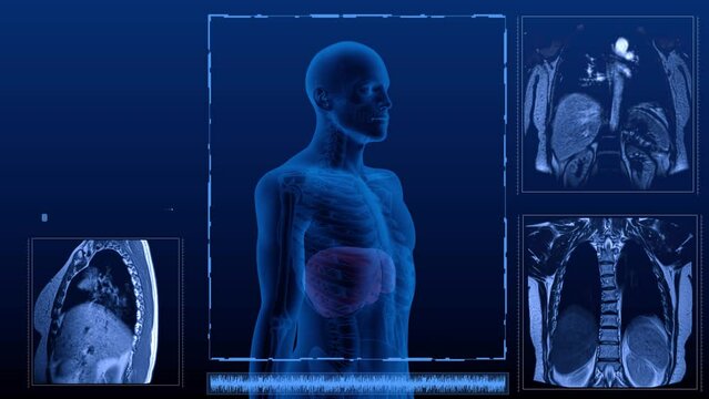 Magnetic resonance tomography  scan in different projections of the human digestive system. Anatomically accurate 3d render animation of the liver