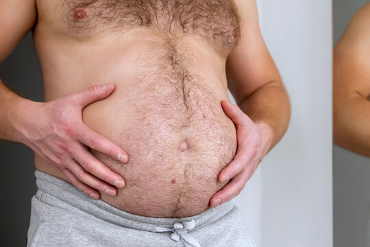 Man with bare fat big belly shakes fat folds on his stomach, obesity, health, beer belly. Problem area of body. Hormones. Overweight. Obesity. Copy space