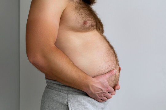 Man with bare fat big belly shakes fat folds on his stomach, obesity, health, beer belly. Problem area of body. Hormones. Overweight. Obesity. Copy space