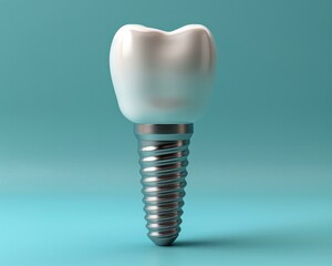 A dental implant on a blue background. Generative AI.