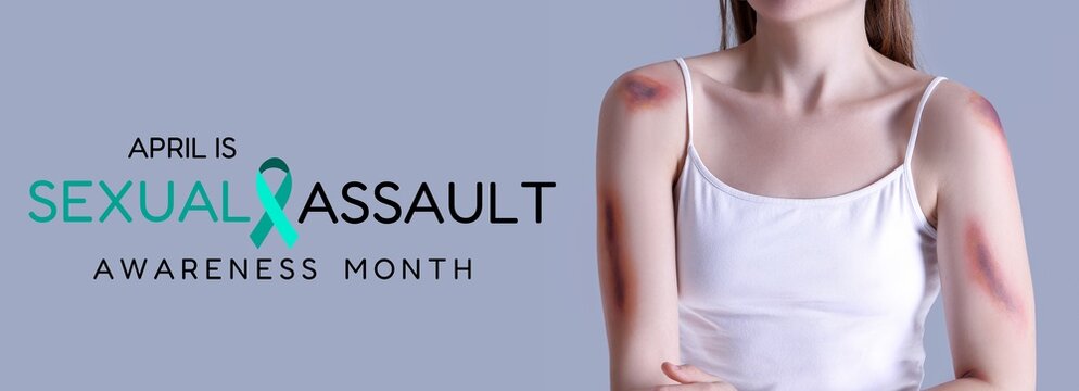 Young woman with bruises on grey background. Banner for Sexual Assault Awareness Month