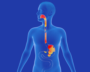 Anatomical 3D illustration of the stomach and esophagus with reflux to the mouth. With ardor and fire. Digestive system and transparent human figure on blue background.