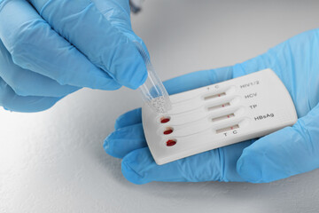 Doctor dropping buffer solution onto disposable multi-infection express test cassette at white...