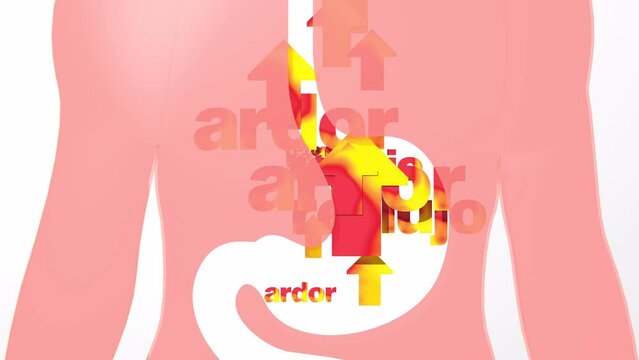 3d animation of digestive system with gastric reflux and heartburn. With flat fire arrows and the words burn and ebb moving upward. Stomach and esophagus cut out on white background.