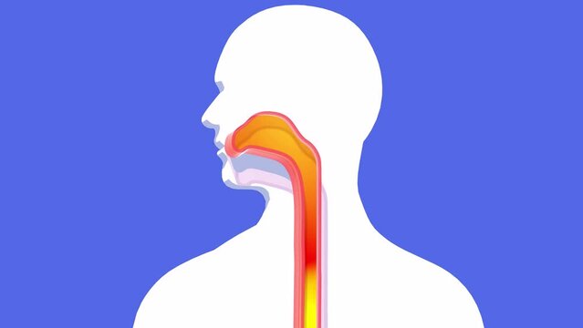 3d animation of stomach and esophagus to the mouth with fire. Reflux and indigestion. Showing the digestive system in relief on cutout human silhouette on blue background.