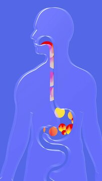 3d animation of esophagus and stomach with gastric reflux and burning. With circles of fire moving upward. Digestive system and human silhouette made of transparent glass on a blue background.