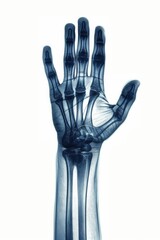 Naklejka premium x-ray image of a hand, white background 