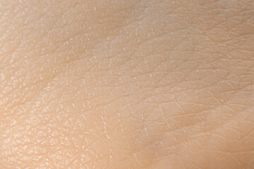 Fototapeta premium Texture of dry skin as background, macro view