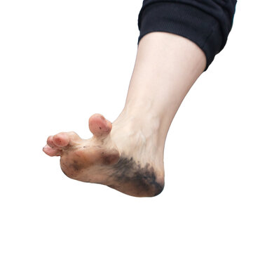 Girl's dirty foot isolated on white background