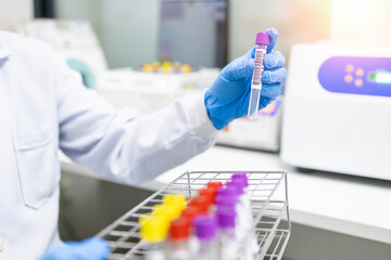 Scientist put laboratory tube or blood tube specimens into the centrifuge machine to test the blood group. Blue glove with an empty tube with a blurred background.