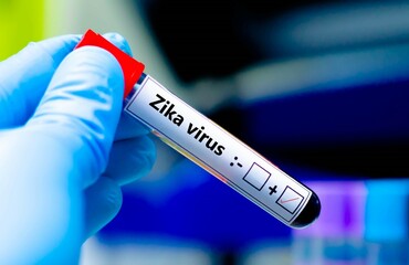 Obraz premium Blood sample of patient positive tested for zika virus.