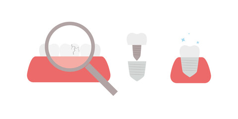 replacement of broken tooth with dental cap