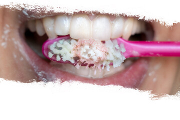 Girl's mouth, toothpaste and toothbrush in mouth on white background, dentistry