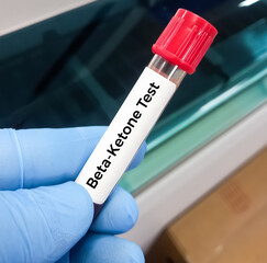 Blood sample tube for ketone test, diagnosis for diabetic ketoacidosis